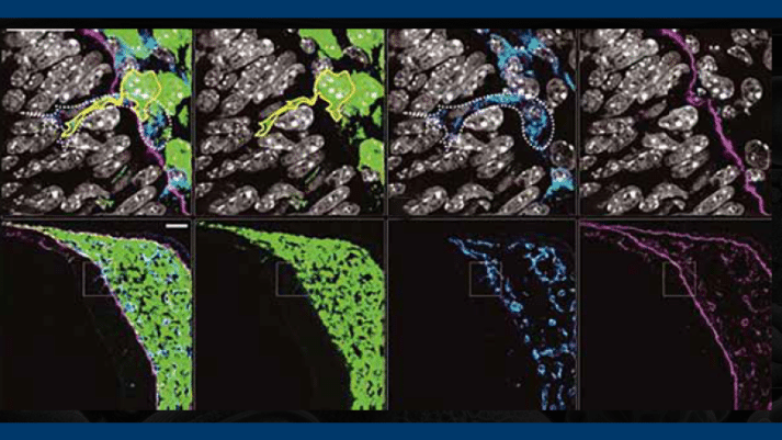 Unlocking the Power of Spatial Biology with the Right Antibody Choices